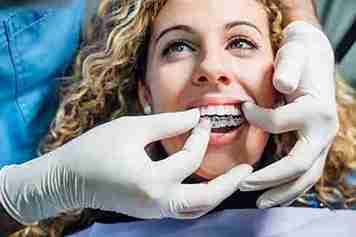 Tips to Maintain Your Invisalign Results Long-Term