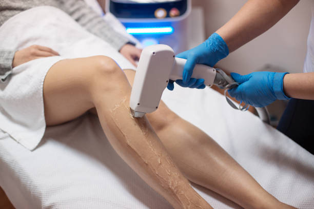Expats in Abu Dhabi Embracing Laser Hair Removal: A Cross-Cultural Aesthetic Trend