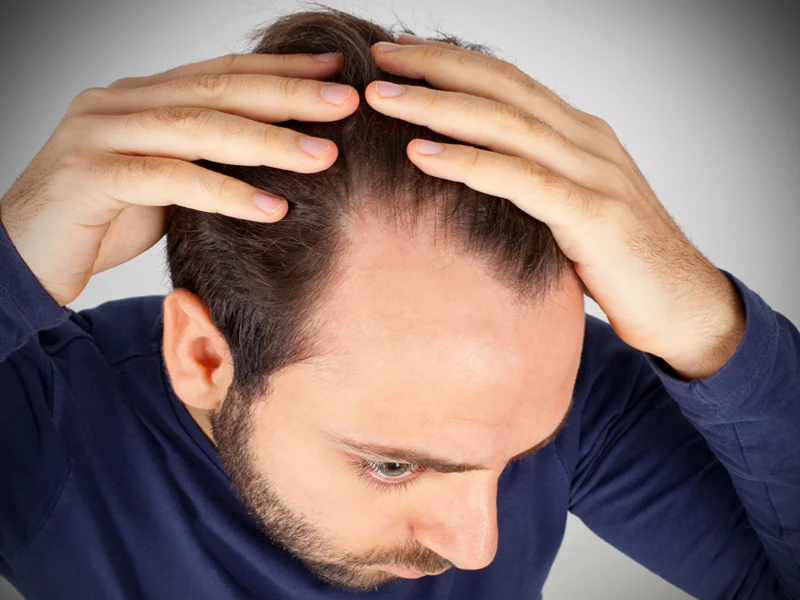 Non-Surgical Hair Loss Dallas | Extensions for Trichotillomania - Zoya Salon